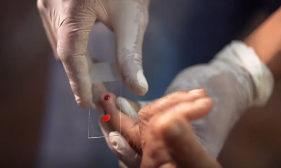 SUS começa a usar novo tratamento contra a malária em crianças